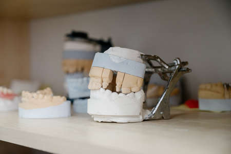 Production of dentures in a dental clinic.The process of creating denturesの写真素材