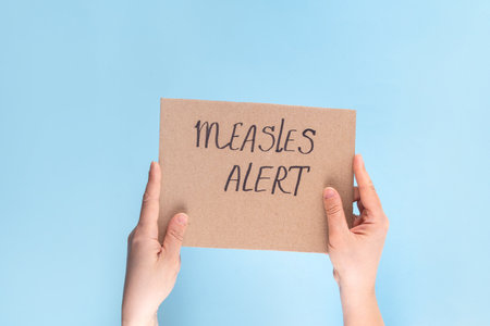Text Measles alert, quarantine on paper banner in woman hand. Female hand hold cardboard with...