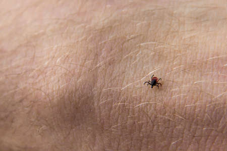 on the body on the arm of a person crawls a red tick miteの写真素材