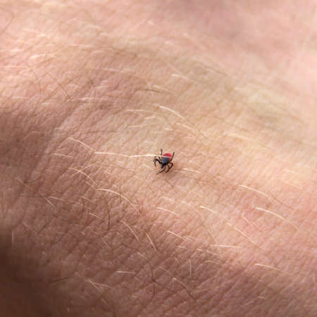 on the body on the arm of a person crawls a red tick miteの写真素材