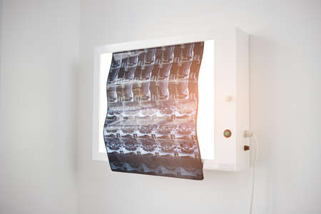 X-ray or mri picture in private clinic. Medicine and healthcare concept