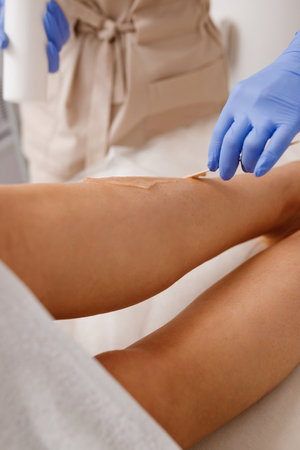 Close up of hair removing procedure on legs. Laser epilation and cosmetology in beauty salonの写真素材