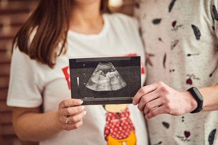 Pregnant lovely couple showing ultrasound scan photo of unborn childの写真素材