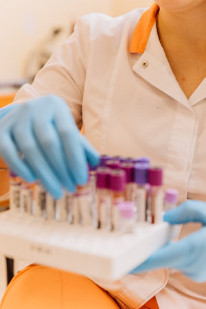Laboratory technician handling blood samples in test tubes for analysis and diagnosticsの写真素材