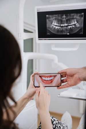 Patient reviewing smile makeover on smartphone with dental Xray displayed in clinic settingの写真素材