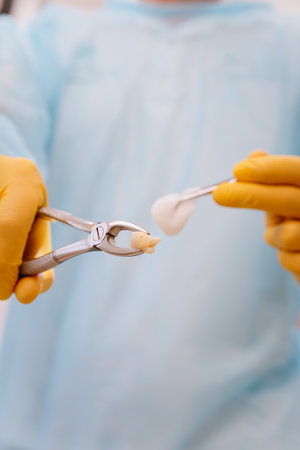 Dentist holding extracted tooth with forceps and cotton swab in a sterile clinical settingの写真素材