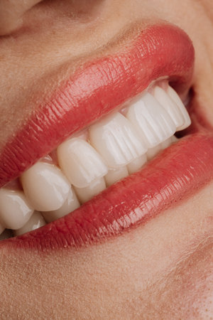 Natural coral lips smile with flawless white porcelain veneers closeup