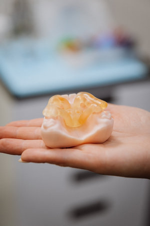 Transparent dental model in clinician hand, clinic closeup