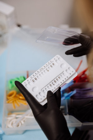 Orthodontic brackets in numbered tray held by gloved clinician, dental clinic closeup