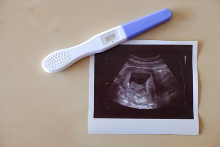 ultrasound with pregnancy test on The Table