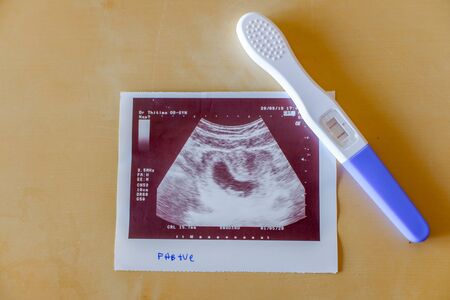 ultrasound with pregnancy test on The Tableの写真素材