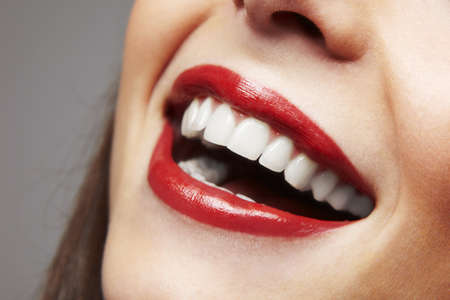 Woman smile  Teeth whitening  Dental care