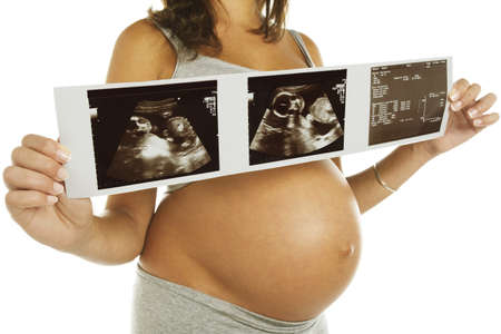 Young pregnant woman with echographyの写真素材