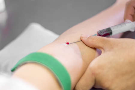 An arm ready for blood testの写真素材