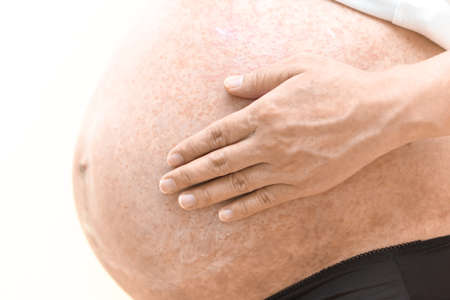 Allergy on pregnant belly, itchy on the skinの写真素材