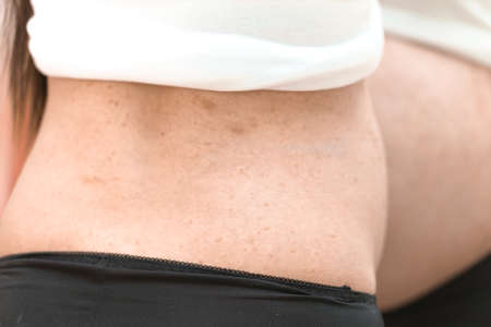 Allergy on pregnant belly, itchy on the skinの写真素材