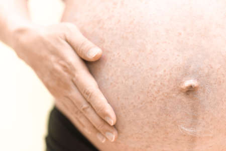 Allergy on pregnant belly, itchy on the skinの写真素材