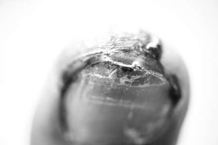 Bleeding from injured toenail on white backgroundの写真素材