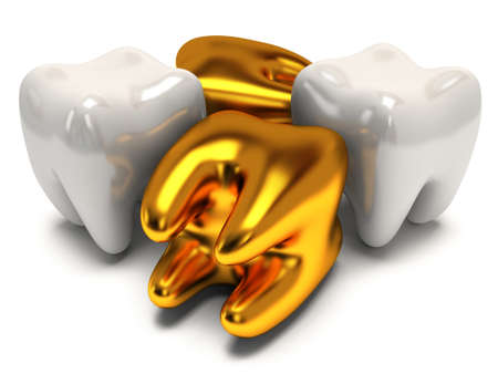 Gold and healthy teeth isolated on white background. 3D render. Dental, medicine, health, out of crowd concept.の写真素材