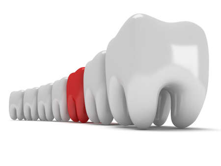 Aching tooth in row of healthy teeth isolated on white background. 3D renderの写真素材