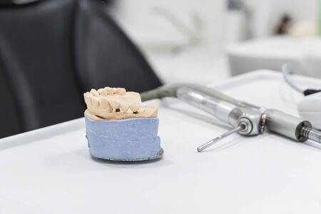 Dental prosthetics on implants, artificial jaw with dentures on the table in the dental office