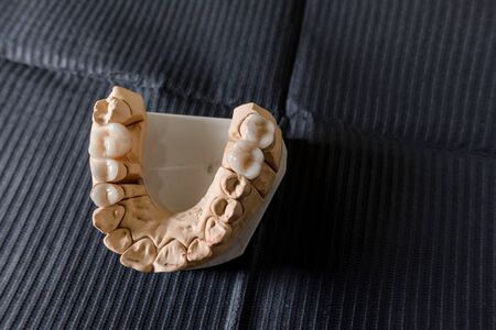 Artificial chew with made tooth crowns and veneers is standing on the table in the dental laboratory. Technical and professional equipmentの写真素材