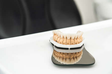 An artificial jaw with veneers and crowns, stands on a surgical glass in a stolmatologic office. Dentistry and treatment conceptの写真素材