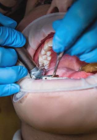 A dentist doctor treats a patients teeth