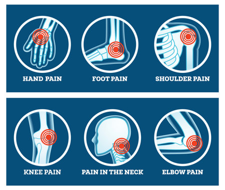 Body Pain. Icons Set. Pain in Hand, Knee, Neck, Elbow, Foot and Shoulder. Woman's and Man's Body Parts.の写真素材
