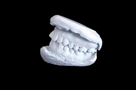 Dental examining, plaster dents model isolated on black backgroundの写真素材