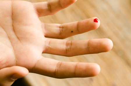 drop of red blood from finger for test glucoseの写真素材