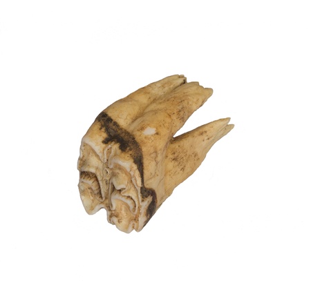 Tooth detail on white