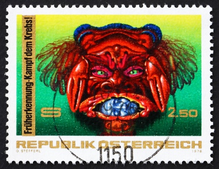 AUSTRIA - CIRCA 1976: a stamp printed in the Austria shows Cancer, Fight against Cancer, circa 1976のeditorial素材