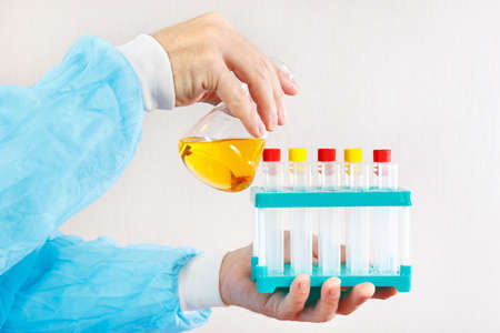 Hands of researcher doing chemical analysis in the laboratory