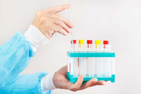 Hands of scientist doing chemical analysis in the laboratory