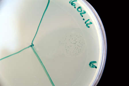 Image illustrates bacteriophages activity  Little spots on the right are area of bacteria lysis...