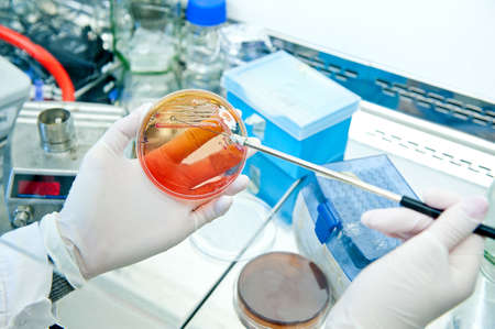 Inoculating loop for spreading bacteria  Petri plate with agar and bacteria escherichia coli の写真素材