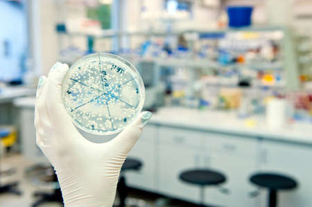 petri dish with agar and bacteria