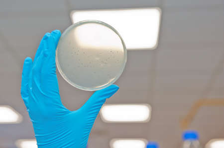 Hand in glove holding petri agar dish with bacterophage plaques