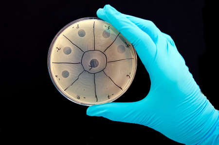 Image illustrates bacteriophages activity  Little spots on the right are area of bacteria lysis...