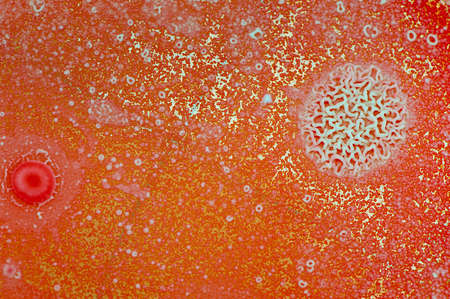 A microbiological background made of yeasts and bacterial coloniescultures in a growth medium.