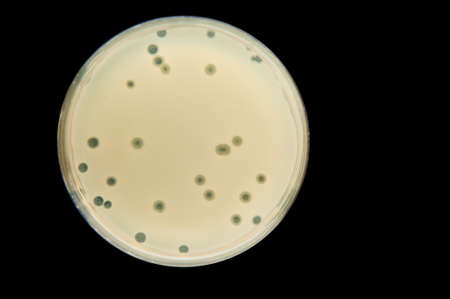 petri dish with bacterial culture with phace activity - plaqueの写真素材