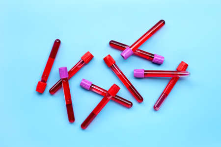 Blood in test tubes on blue background. Top viewの写真素材