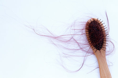 Hairs loss fall in comb on white background.の写真素材