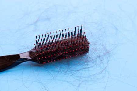 Hairs loss fall in comb on blue background.の写真素材