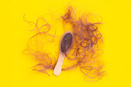 Hairs loss fall in combs on yellow background.の写真素材
