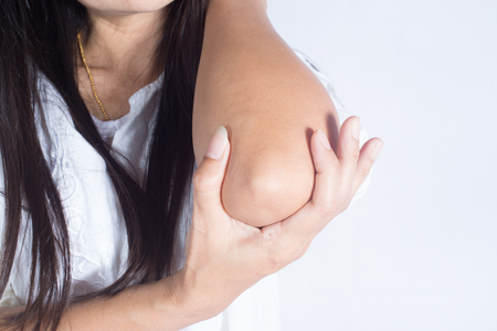 Asian Woman injured elbow.の写真素材