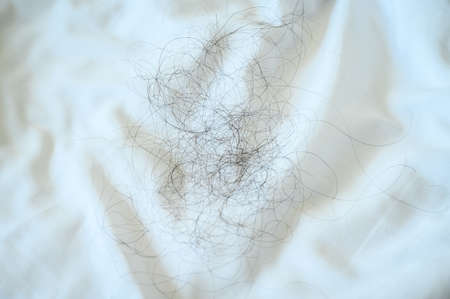 Group of woman long hair fall down on white bed sheet. Hair loss maybe related from Family history (heredity) or Hormonal changes and medical conditions. Hair loss problem on white background.の写真素材