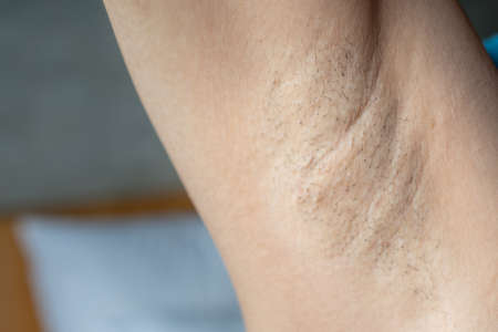 Close up of woman showing her unshaved armpit. Unshaven women often meet other criteria for...