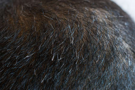 Cropped shot view of Asian men head with few grey hair growing. Hair turns white when the pigmentation cells responsible for colour (melanin) stop being produced.の写真素材